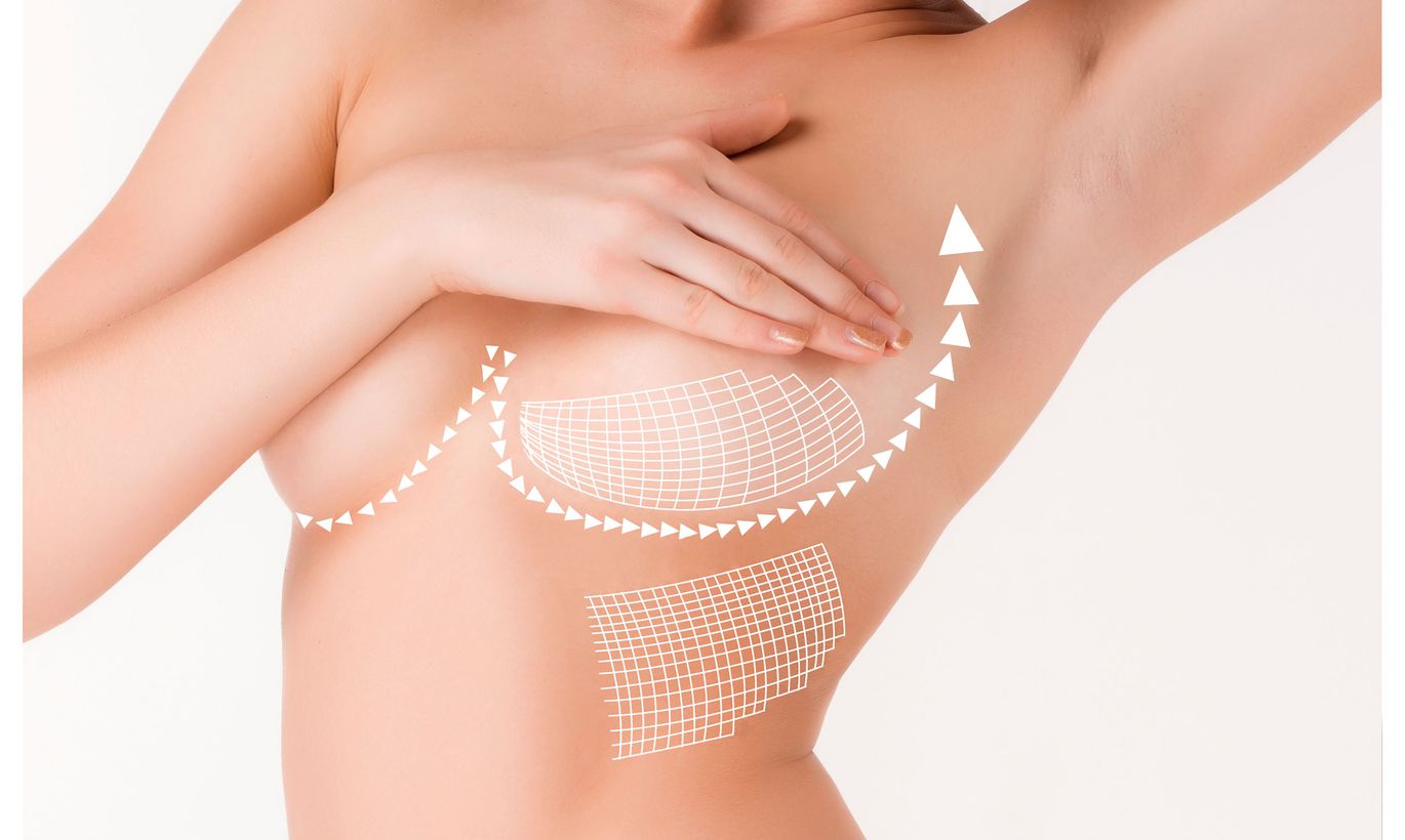 уменьшение объема груди у женщин фото 100